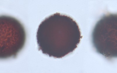 Elaphomyces  granulatus spores