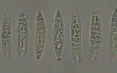 Leptogium australe spores